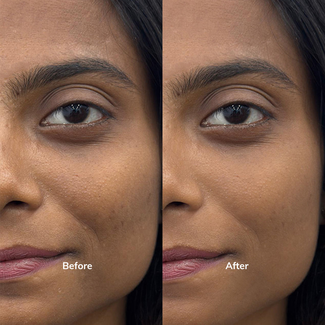 Hyperpigmentation Mushroom Complex Serum with Tranexamic Acid | 30 ml