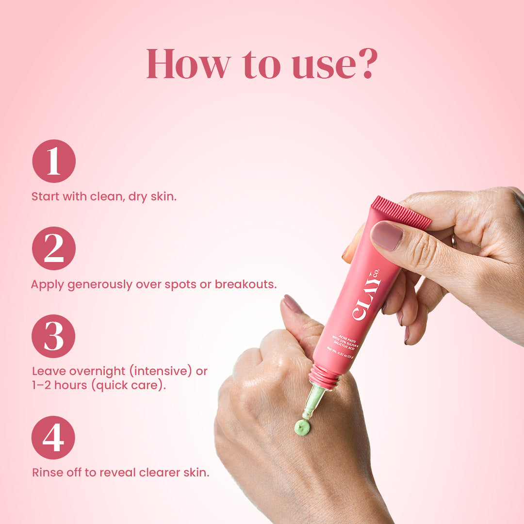 Acne Paste with 10% Sulfur & Salicylic Acid | 15g