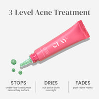 Acne Paste with 10% Sulfur & Salicylic Acid | 15g