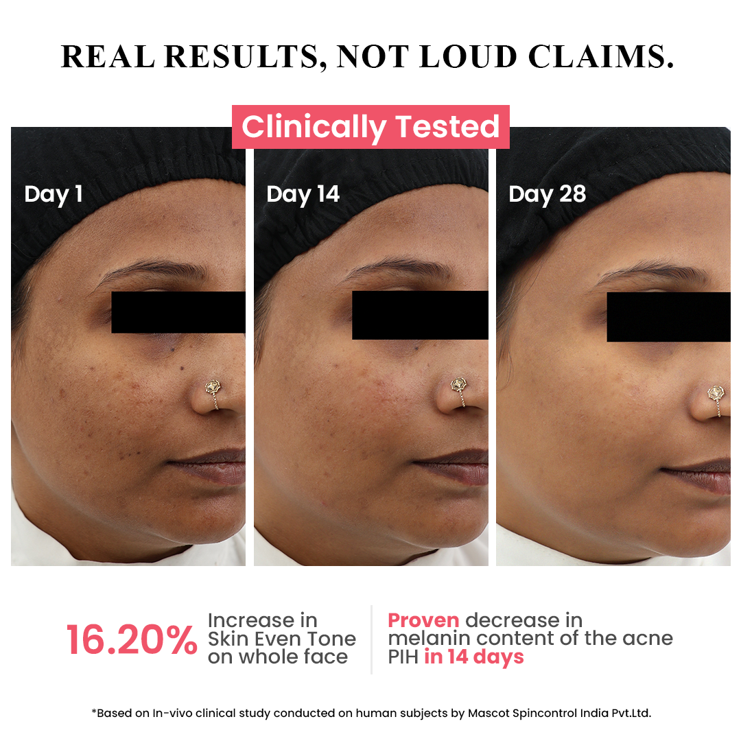 Hyperpigmentation Mushroom Complex Serum with Tranexamic Acid | 30 ml
